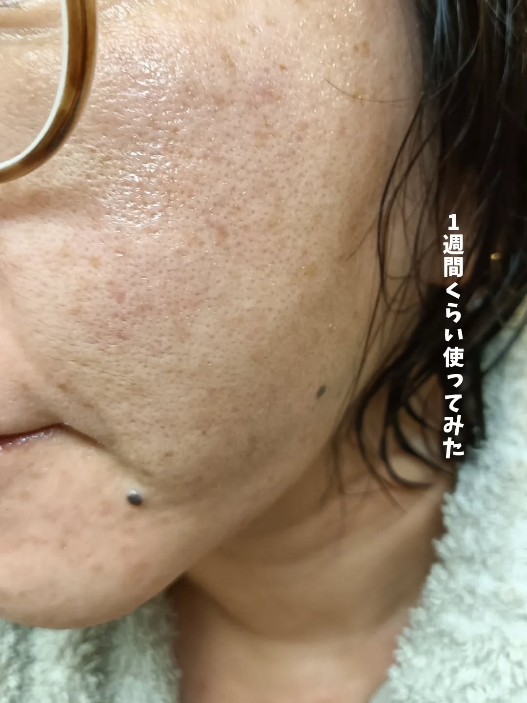 ダーマジェンシー ゼロカ81 クリーム/DERMAGENCY/フェイスクリームを使ったクチコミ（3枚目）