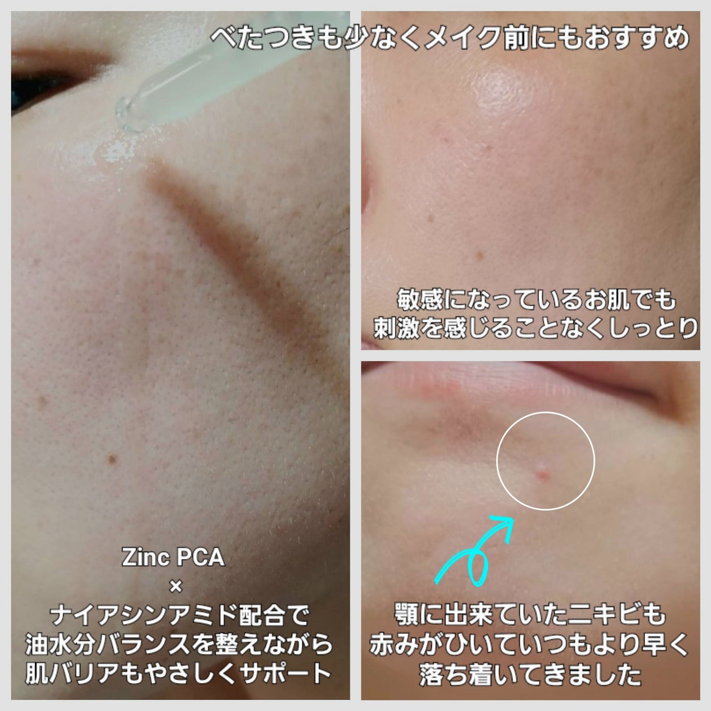 青麦ジンクセラム/Veganifect/美容液を使ったクチコミ(3枚目)