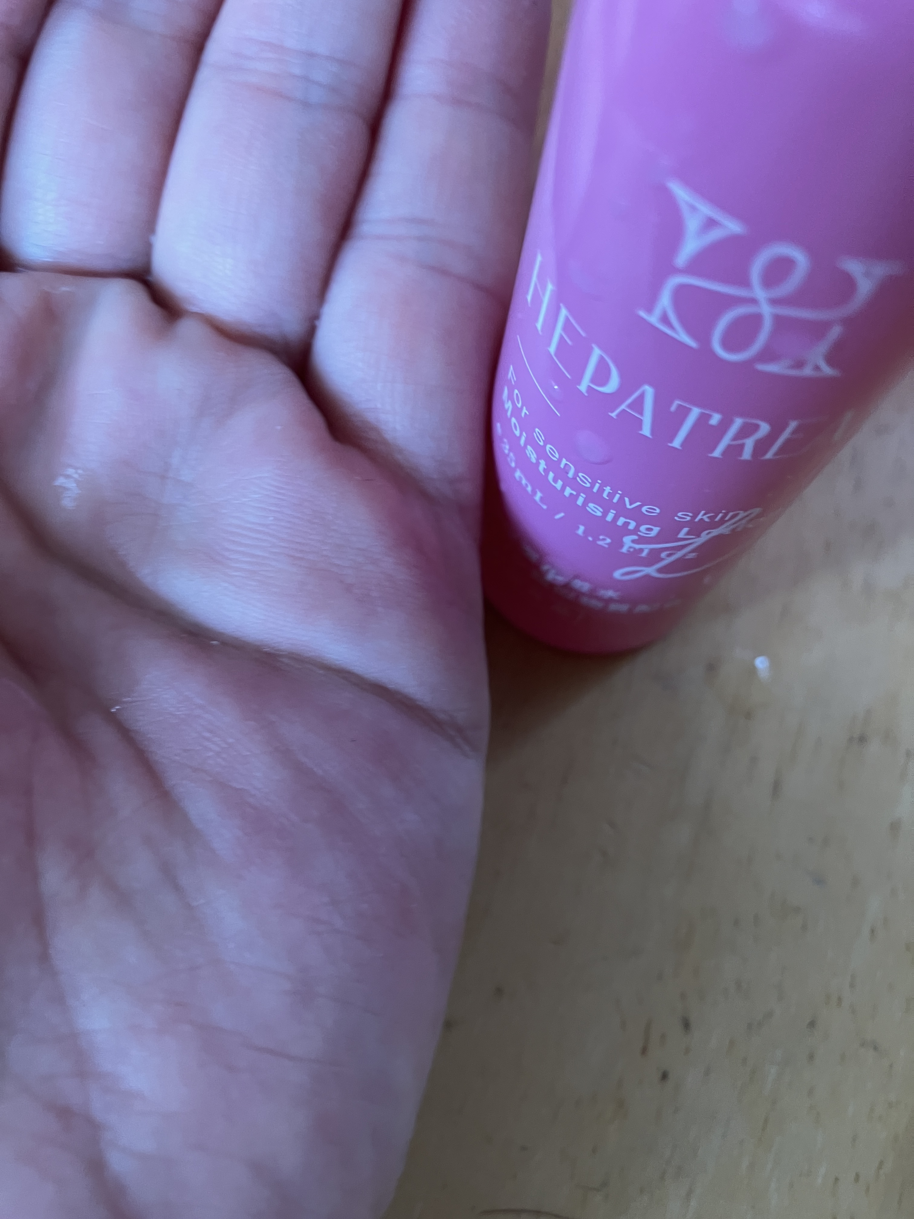 ヘパトリート 薬用保湿化粧水/ゼトックスタイル/化粧水を使ったクチコミ（2枚目）