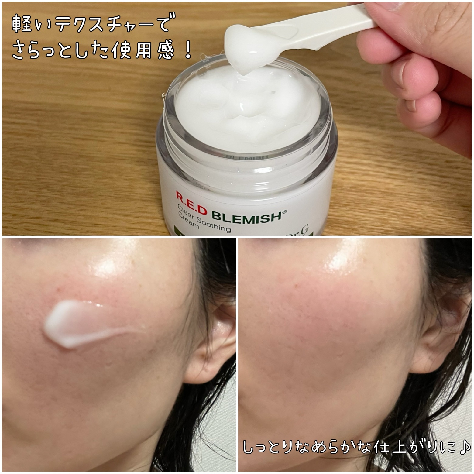 レッドブレミッシュ クリアスージングクリーム/Dr.G/フェイスクリームを使ったクチコミ（2枚目）