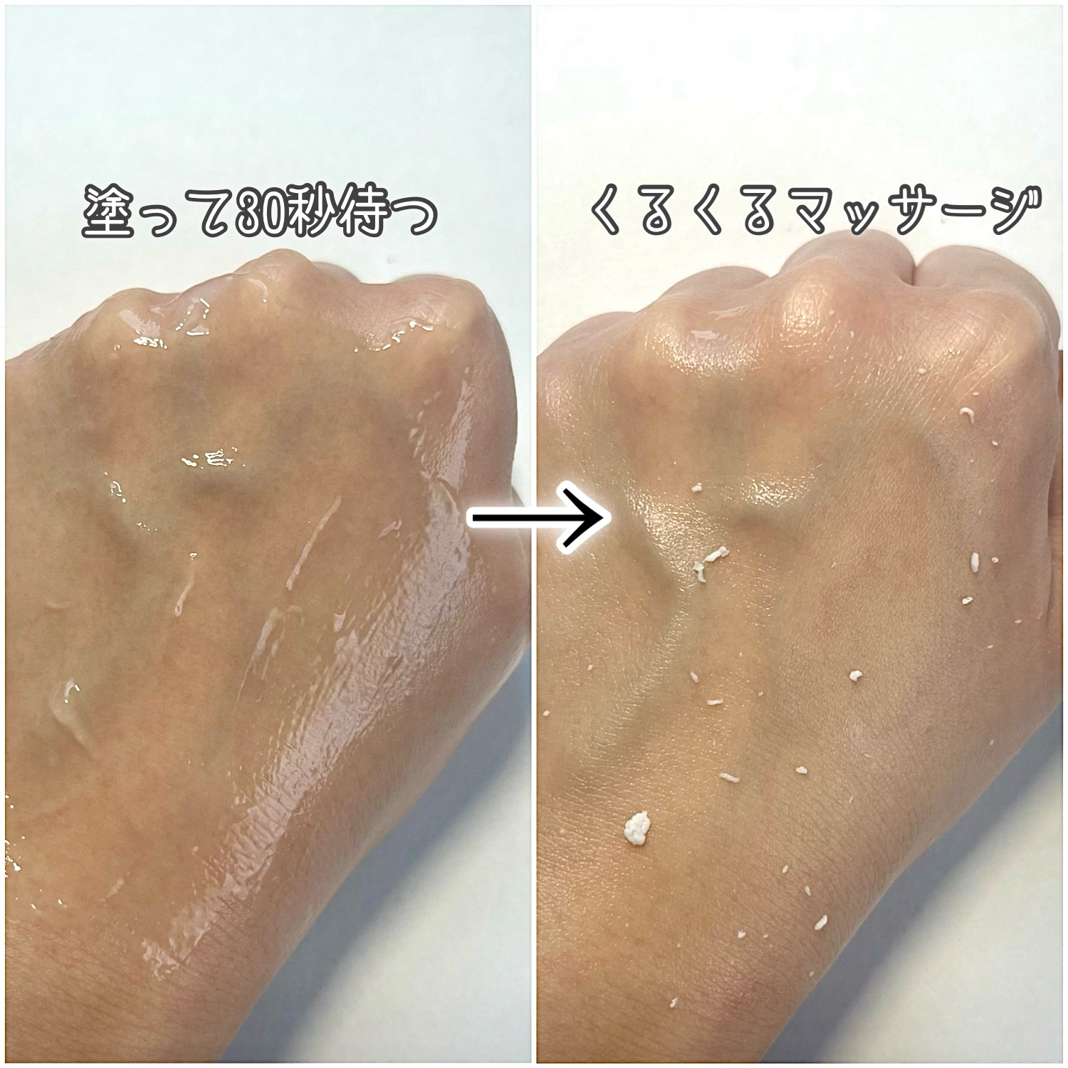 ナチュラルアクアジェル/Cure/ピーリングを使ったクチコミ（2枚目）