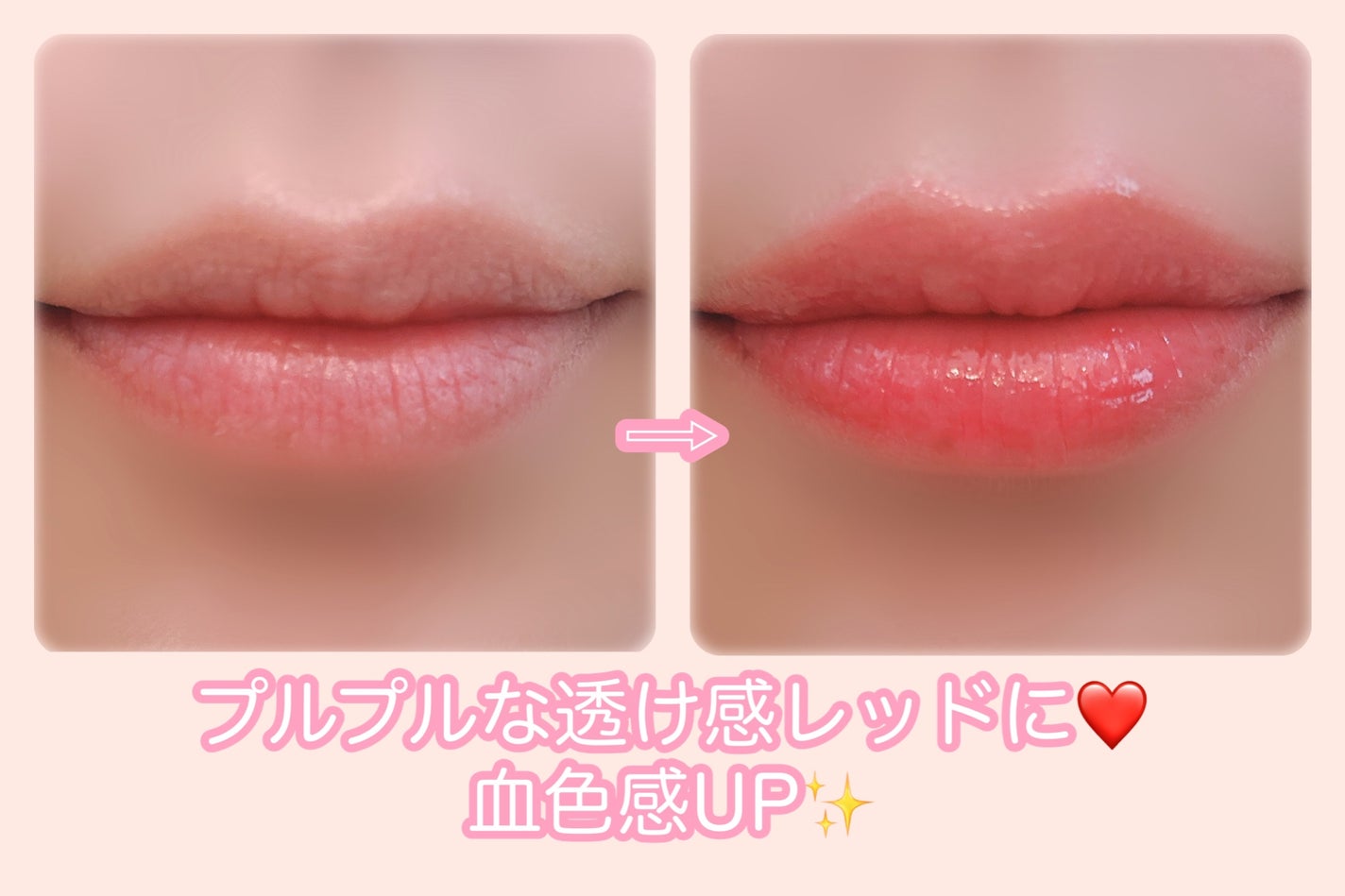 ユース ラディアンス ビタチノール セラム/primera/美容液を使ったクチコミ(10枚目)