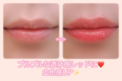 ユース ラディアンス ビタチノール セラム/primera/美容液を使ったクチコミ(10枚目)