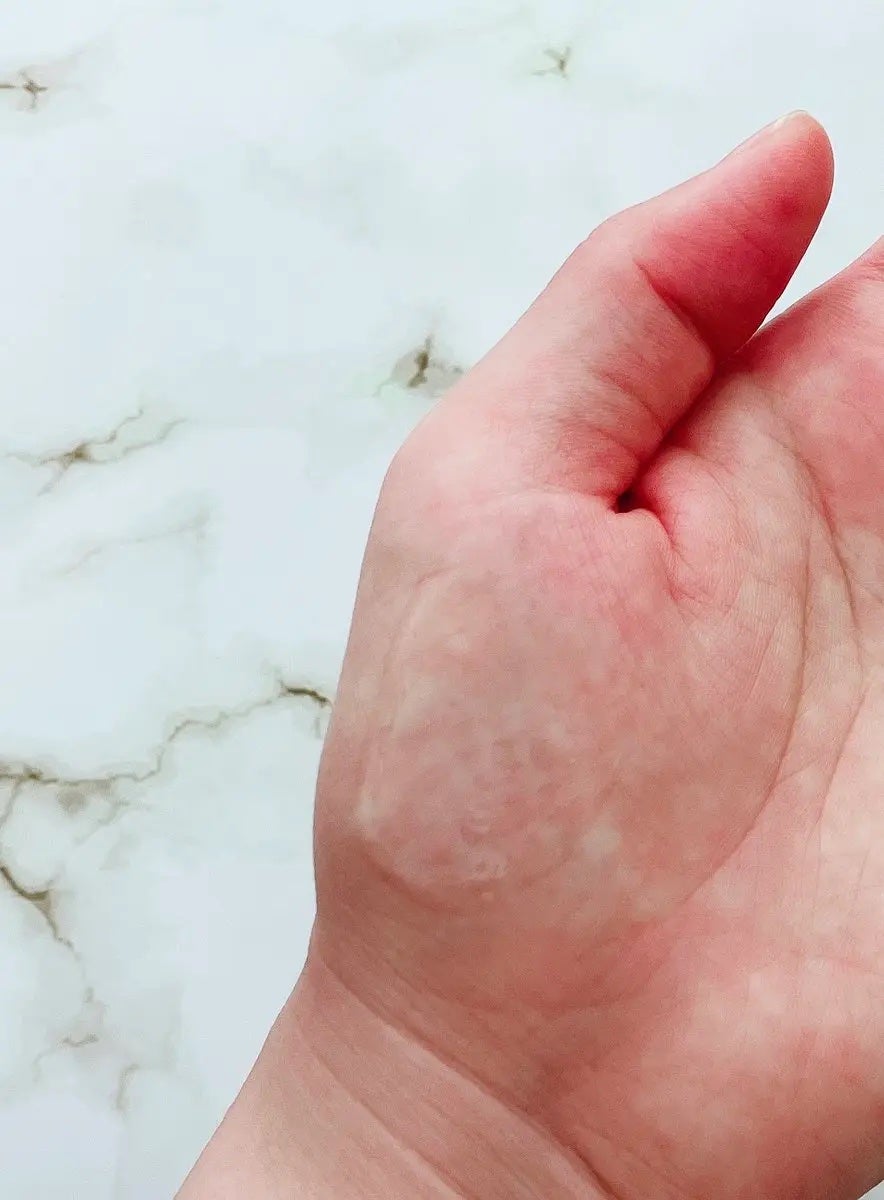 ダーマジェンシー ゼロカ81 セラム/DERMAGENCY/美容液を使ったクチコミ(3枚目)