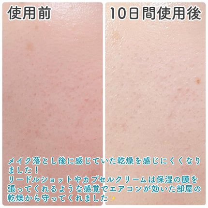 PDRN リードルショット100/VT/ブースター・導入液を使ったクチコミ(5枚目)