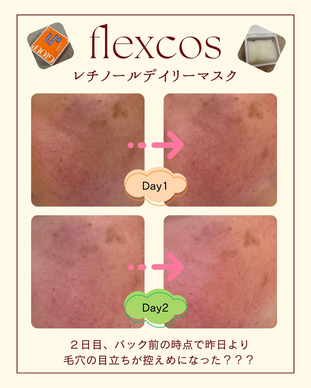 flexcos GLOUP Derma Retinol Plus Daily mask/flexcos/シートマスク・パックを使ったクチコミ（2枚目）