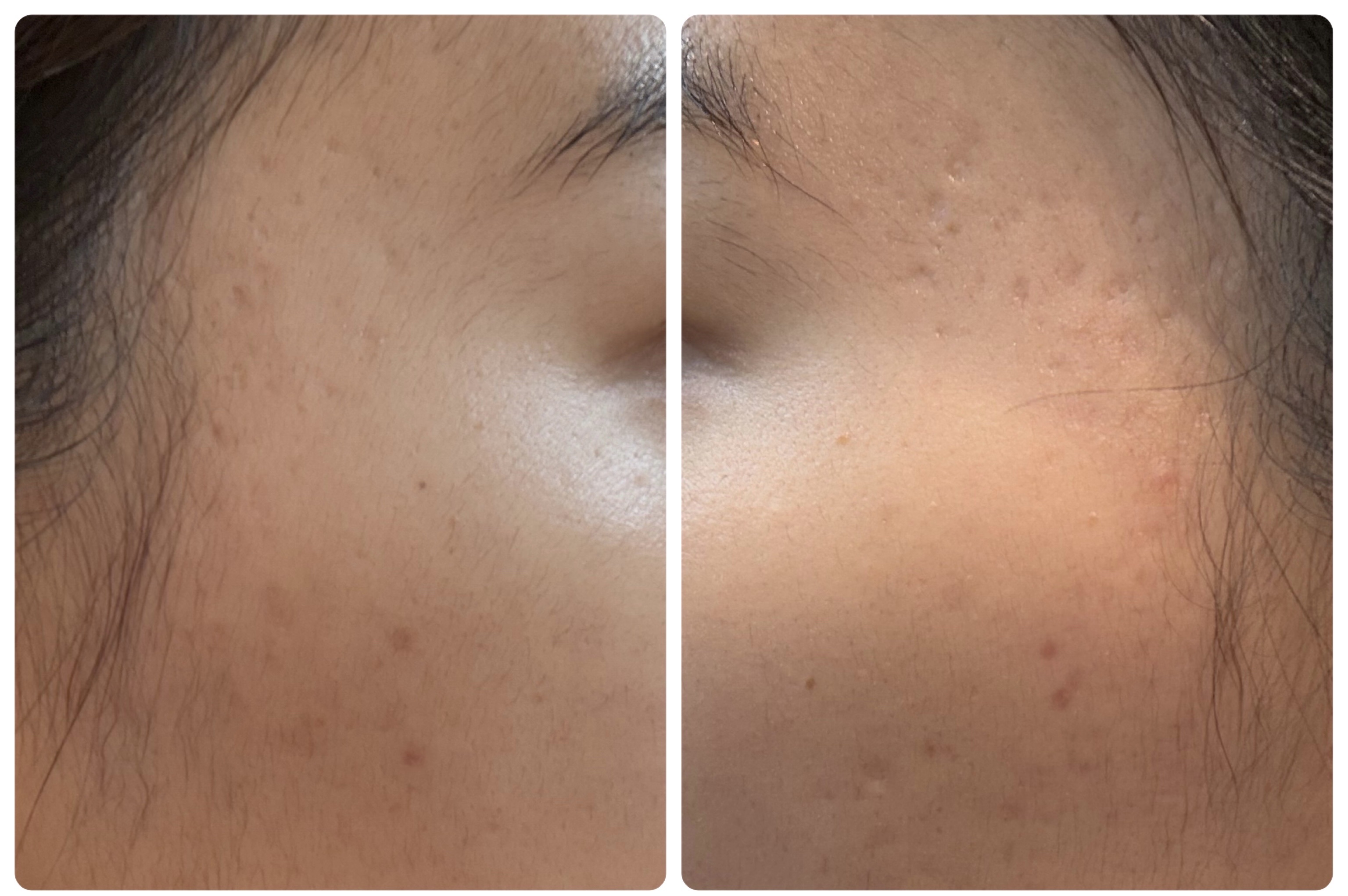 AGE-R ブースタープロ/MEDICUBE/美顔器・マッサージを使ったクチコミ（2枚目）