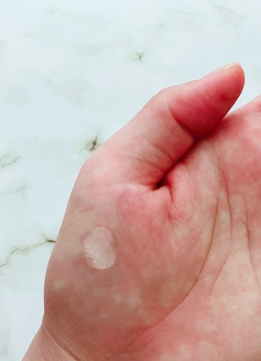 ダーマジェンシー ゼロカ81 セラム/DERMAGENCY/美容液を使ったクチコミ(2枚目)