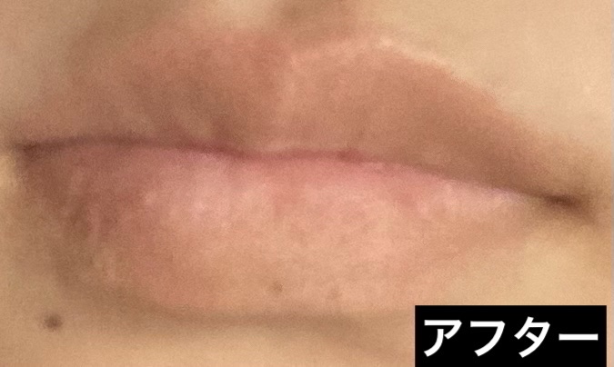 ボリューム Ｗリップライナー/Visée/リップライナーを使ったクチコミ（3枚目）