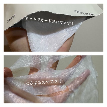 トラブルパッチマスク/EIOM/その他スキンケアを使ったクチコミ(3枚目)