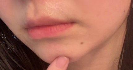 レッドブレミッシュ クリアスージングクリーム/Dr.G/フェイスクリームを使ったクチコミ(4枚目)