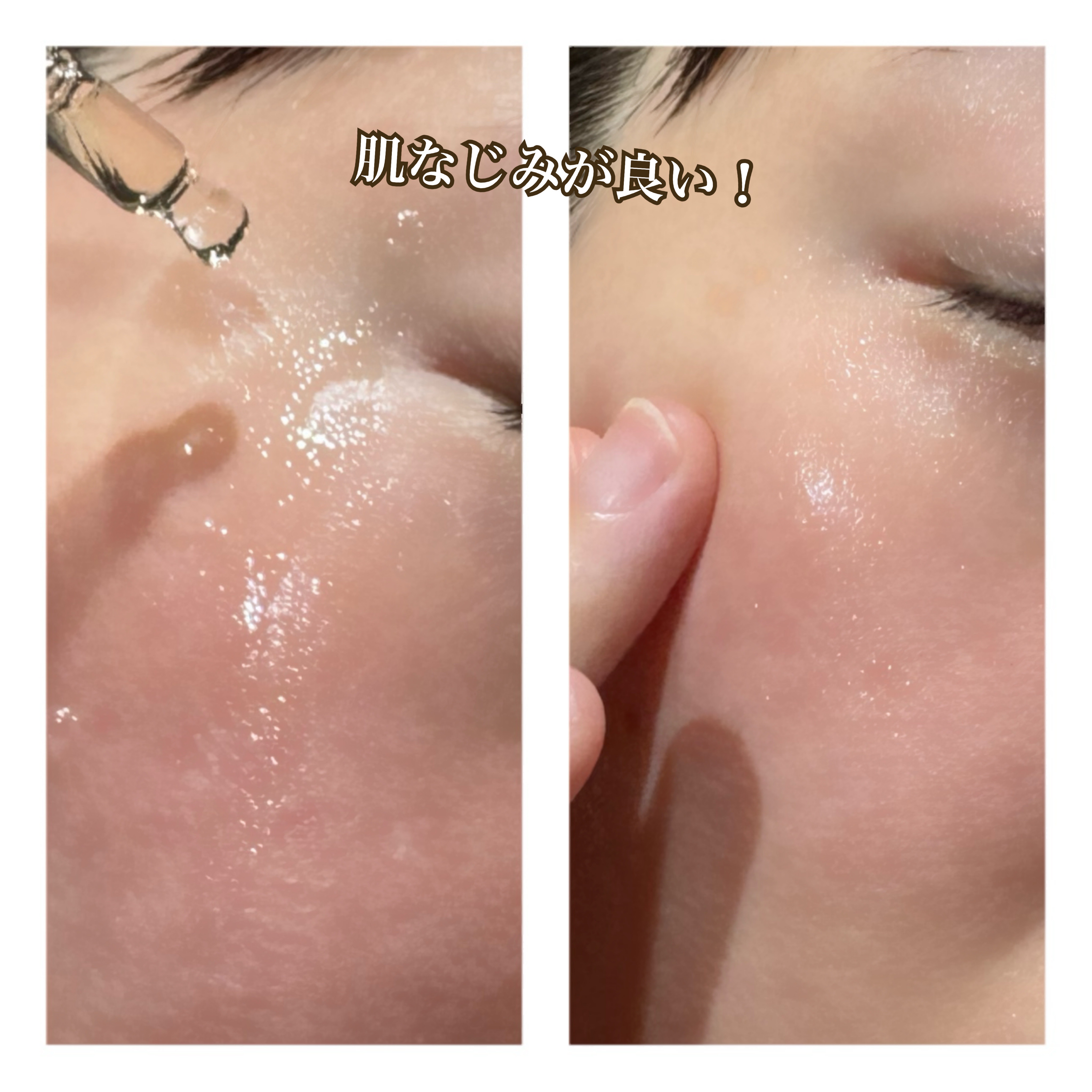 アクネクスアンプル/EIOM/美容液を使ったクチコミ（3枚目）