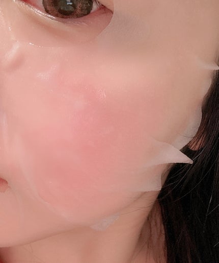 メディリフト ニードルリフトシートマスク/YA-MAN TOKYO JAPAN/シートマスク・パックを使ったクチコミ(4枚目)