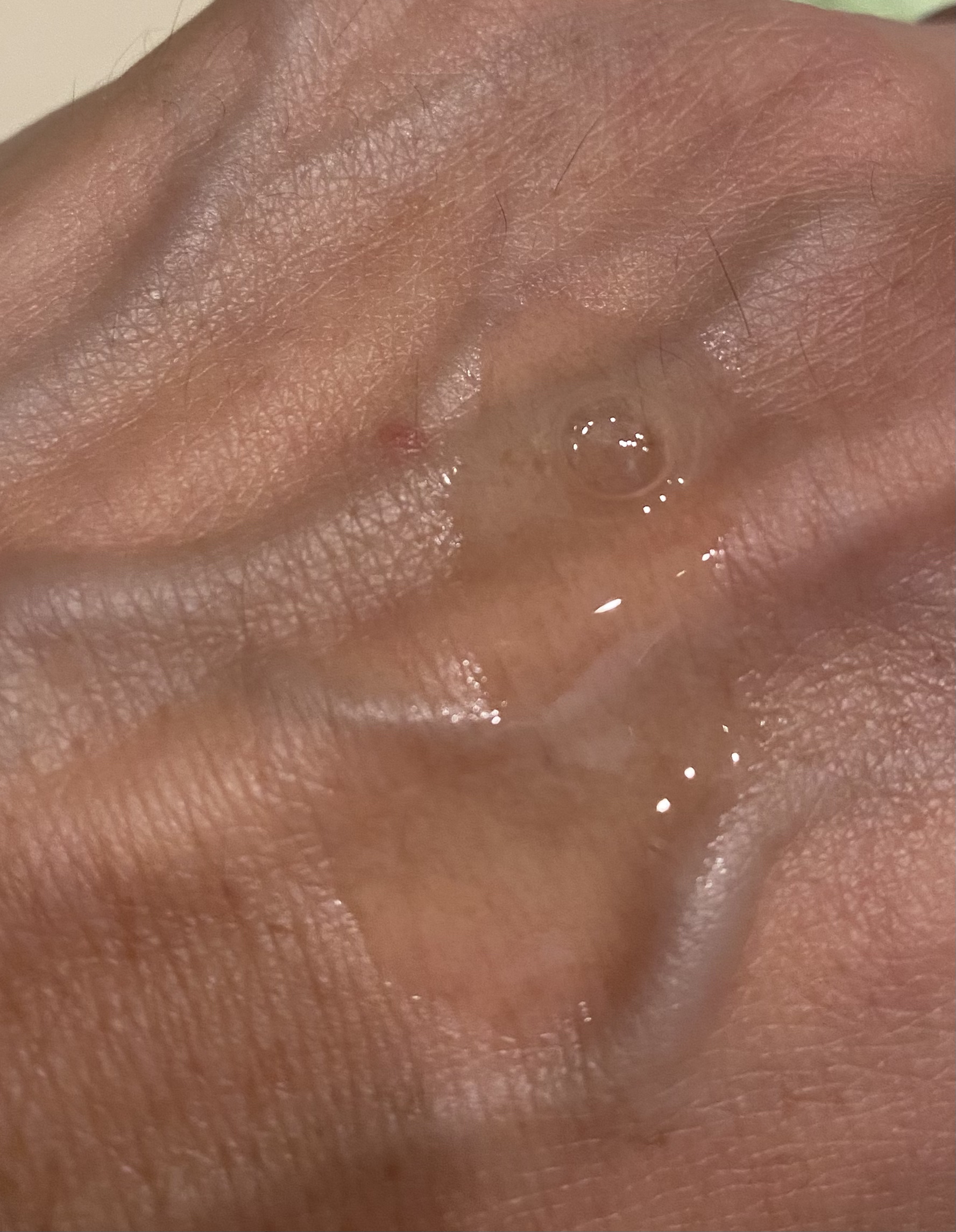 ビタトーニングセラムトナー/ダルバ/化粧水を使ったクチコミ（3枚目）