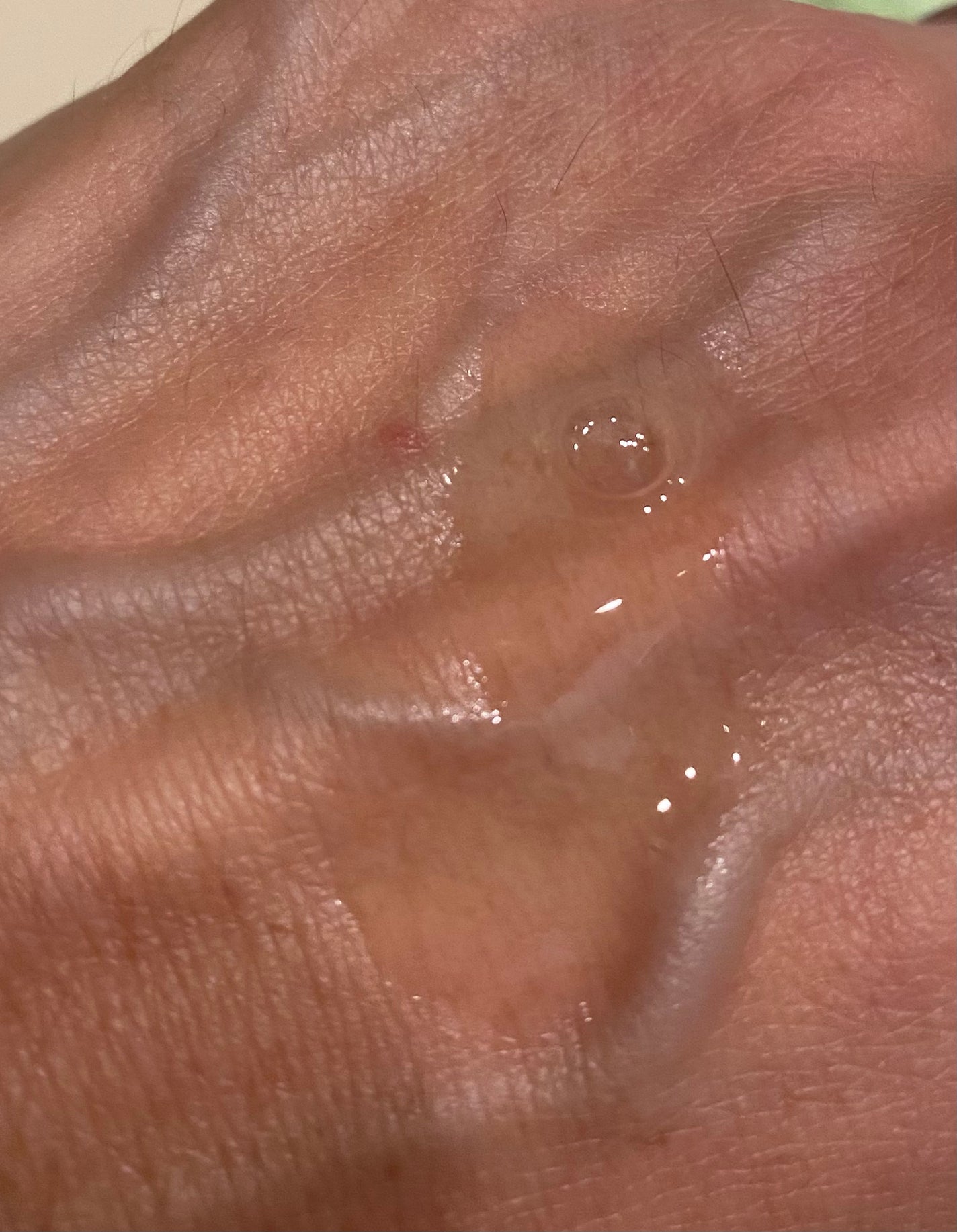 ビタトーニングセラムトナー/ダルバ/化粧水を使ったクチコミ(3枚目)