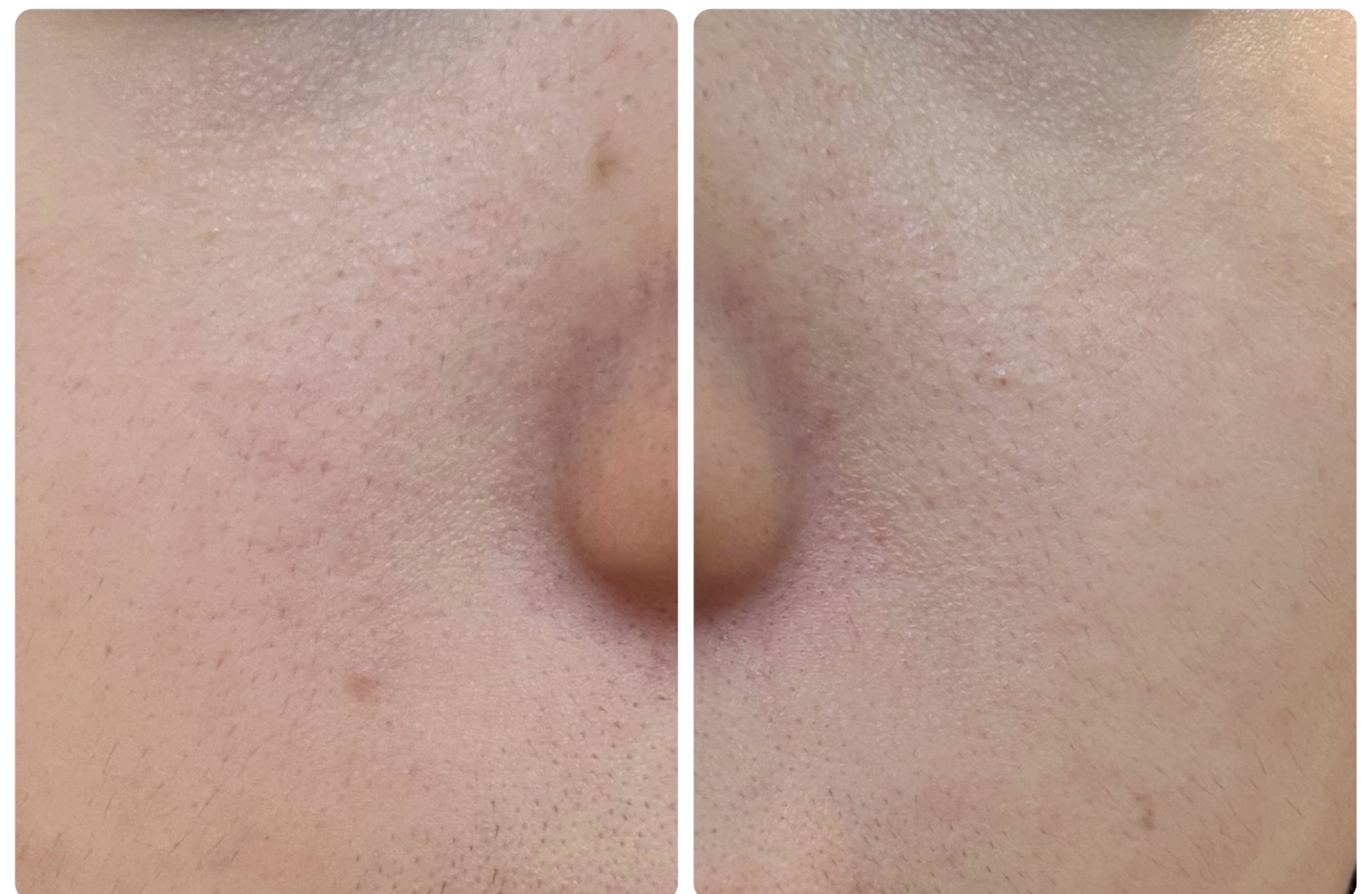 Hadaral 十味敗毒湯錠(医薬品)/大峰堂/その他を使ったクチコミ（3枚目）