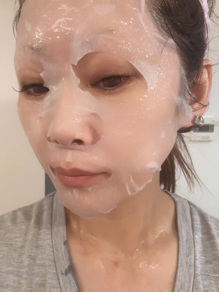 メディリフト ニードルリフトシートマスク/YA-MAN TOKYO JAPAN/シートマスク・パックを使ったクチコミ(5枚目)