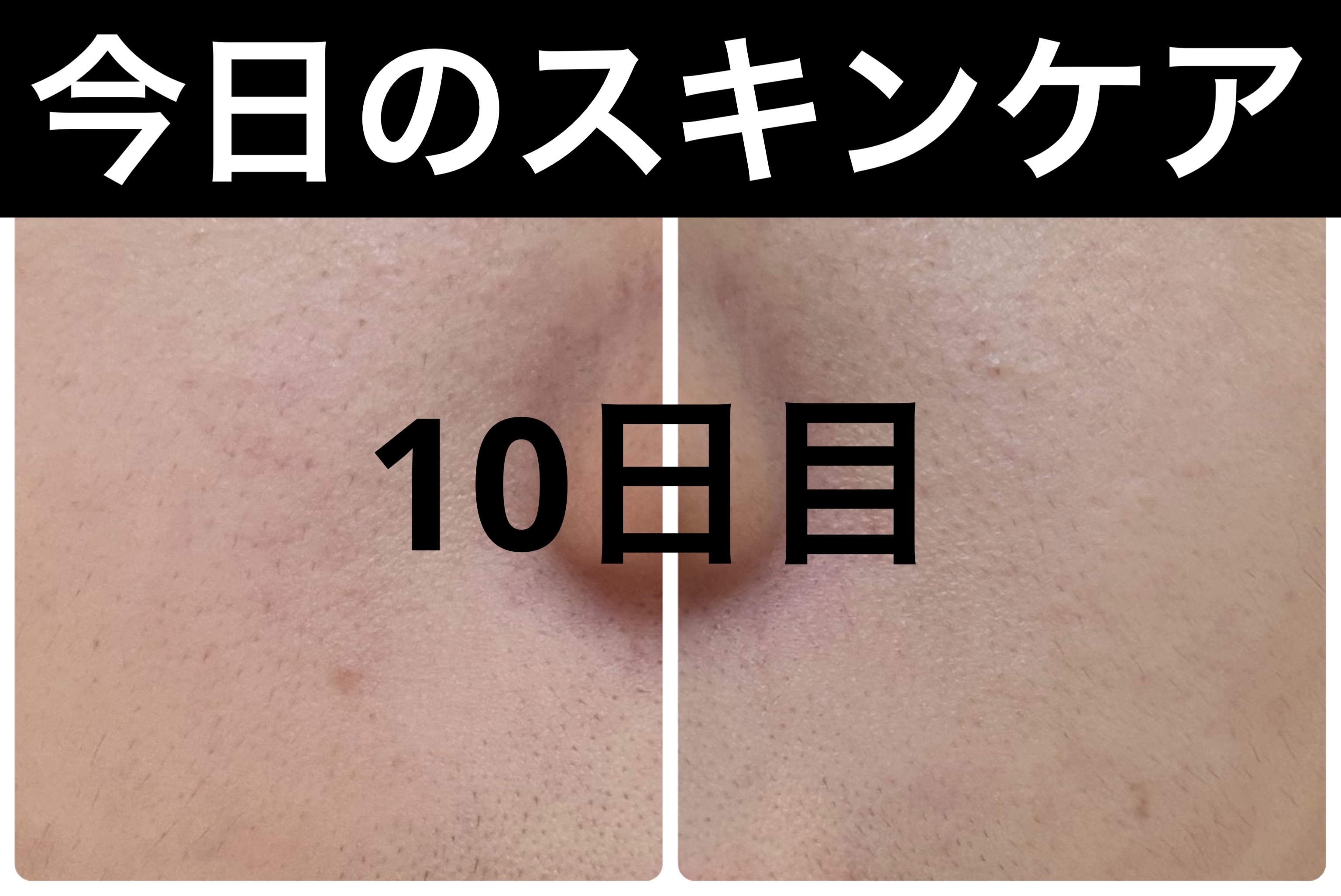 Hadaral 十味敗毒湯錠(医薬品)/大峰堂/その他を使ったクチコミ（1枚目）