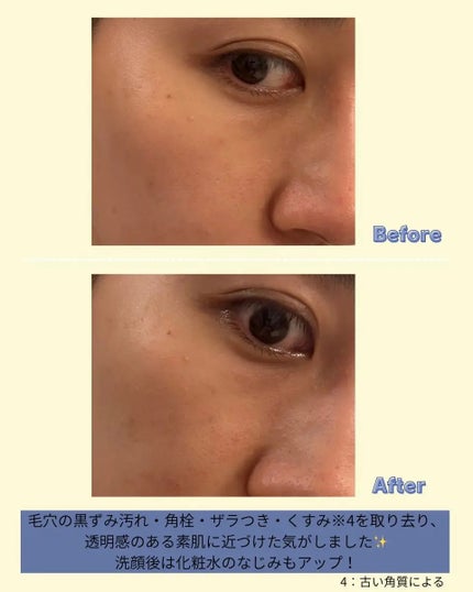 スペシャルパウダーソープVC/Cure/洗顔パウダーを使ったクチコミ(3枚目)