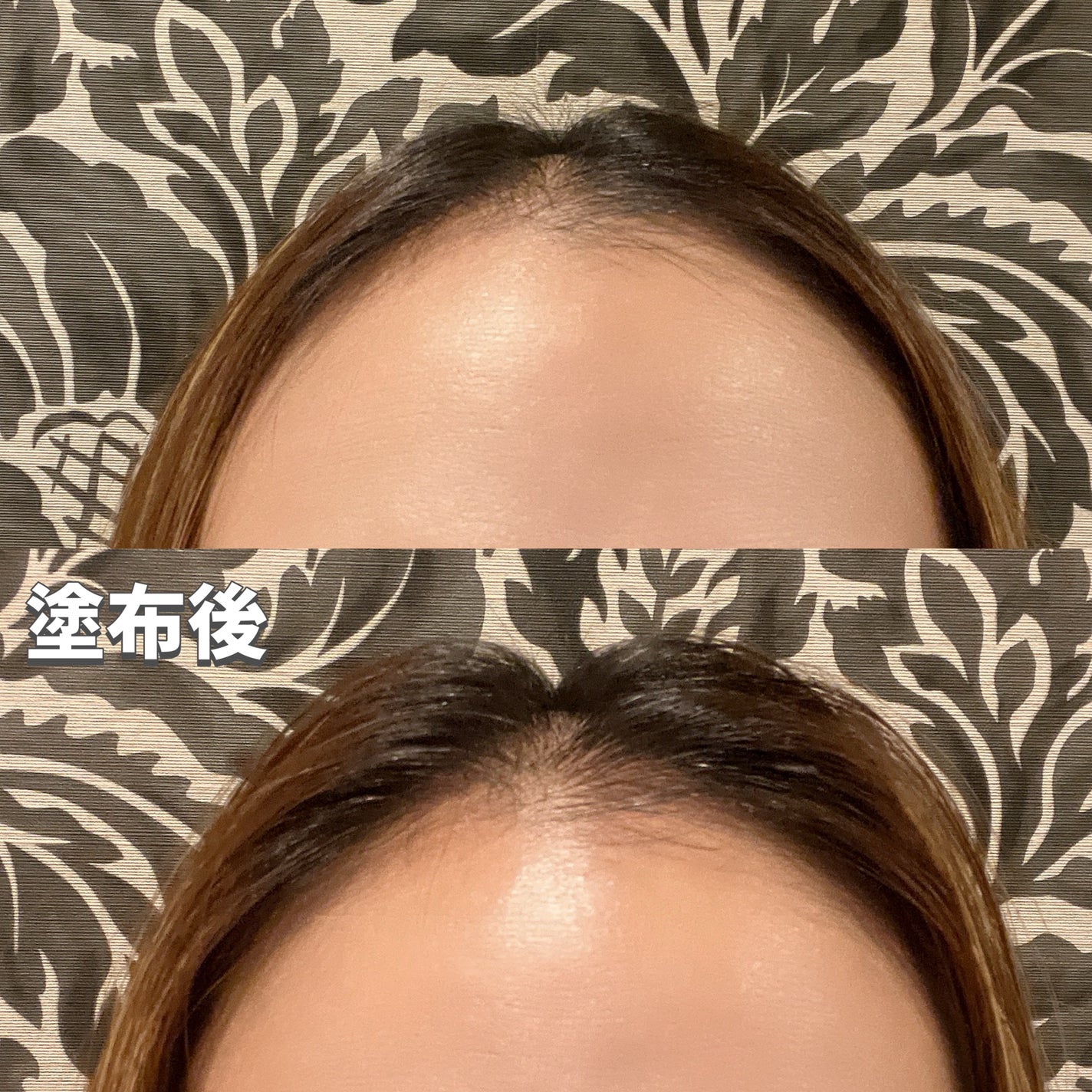 スカルプD ボーテ メディカルエストロジー スカルプセラム/アンファー(スカルプD)/頭皮ローションを使ったクチコミ(5枚目)