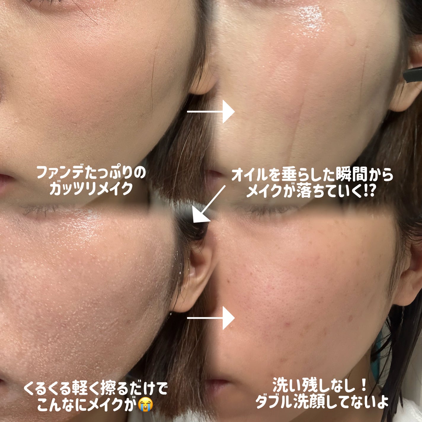 AZケア クレンジングオイル/VT/オイルクレンジングを使ったクチコミ(2枚目)