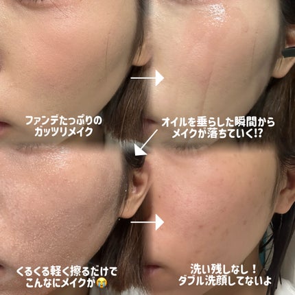 AZケア クレンジングオイル/VT/オイルクレンジングを使ったクチコミ(2枚目)