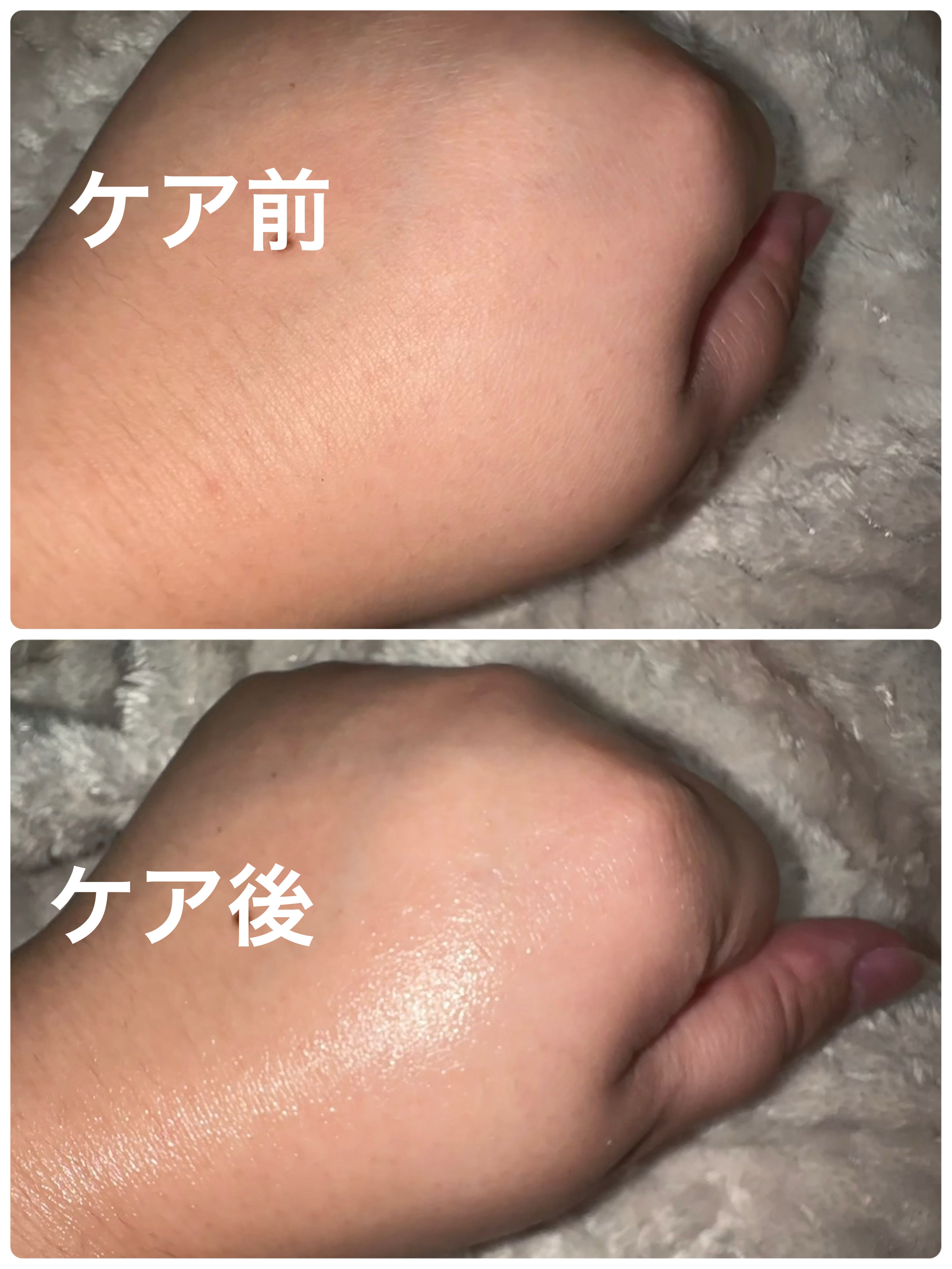 KIRAKIRAトラベルキット/BEAUTIFUL SILICA/トライアルキットを使ったクチコミ（3枚目）