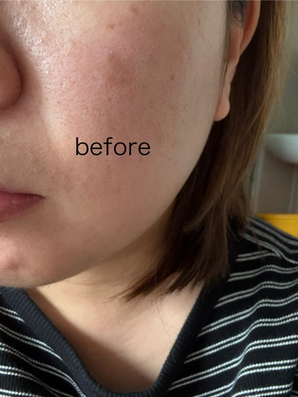 リフレクション スキン グロウ クッション ファンデーション/HERA/クッションファンデーションを使ったクチコミ(2枚目)