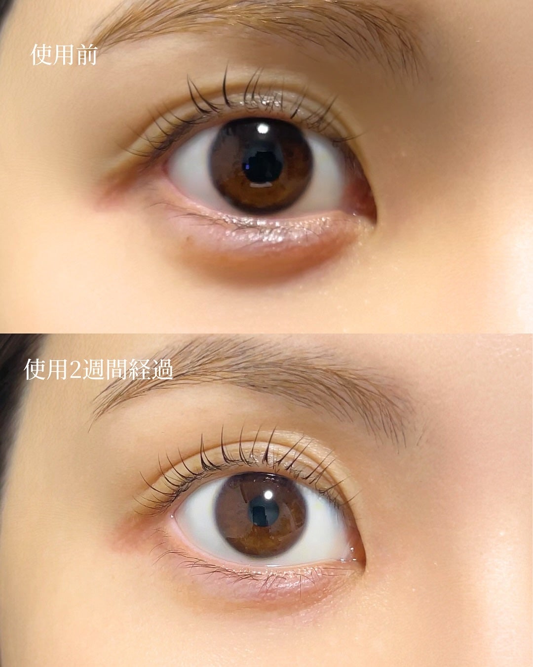 スカルプDまつ毛美容液 クイーン/アンファー(スカルプD)/まつげ美容液を使ったクチコミ(3枚目)
