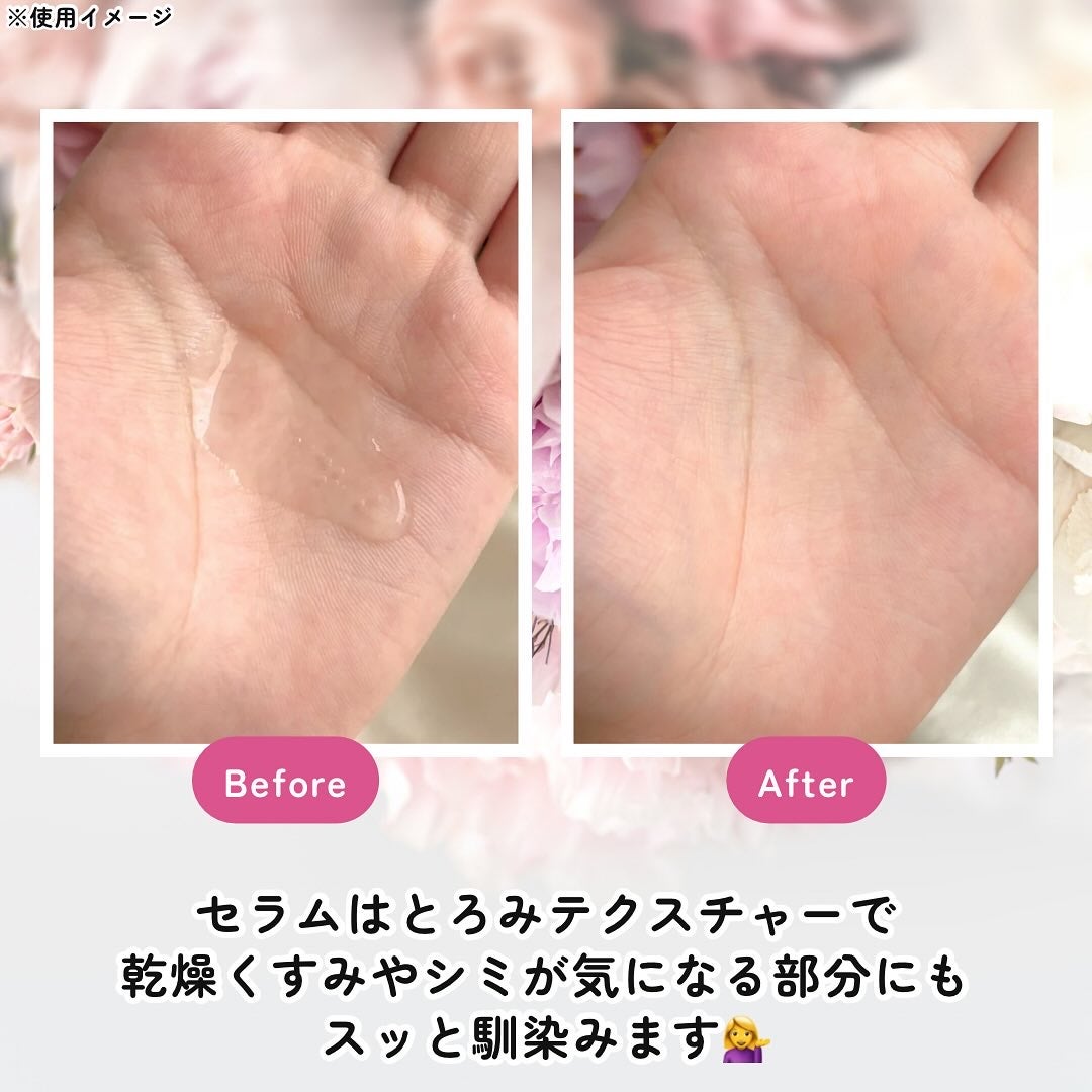 ビタ3セラム/オーズナリー/美容液を使ったクチコミ(4枚目)