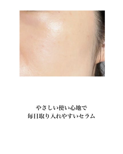 青麦ジンクセラム/Veganifect/美容液を使ったクチコミ(5枚目)