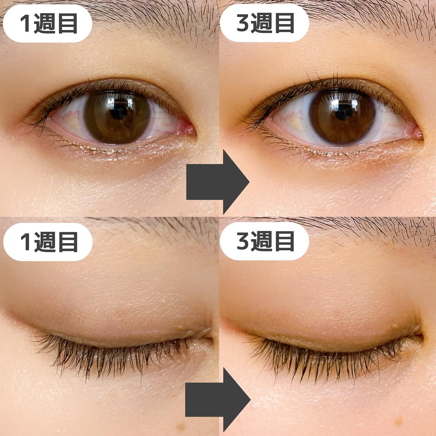 スカルプDまつ毛美容液　クイーン/アンファー(スカルプD)/まつげ美容液を使ったクチコミ（2枚目）