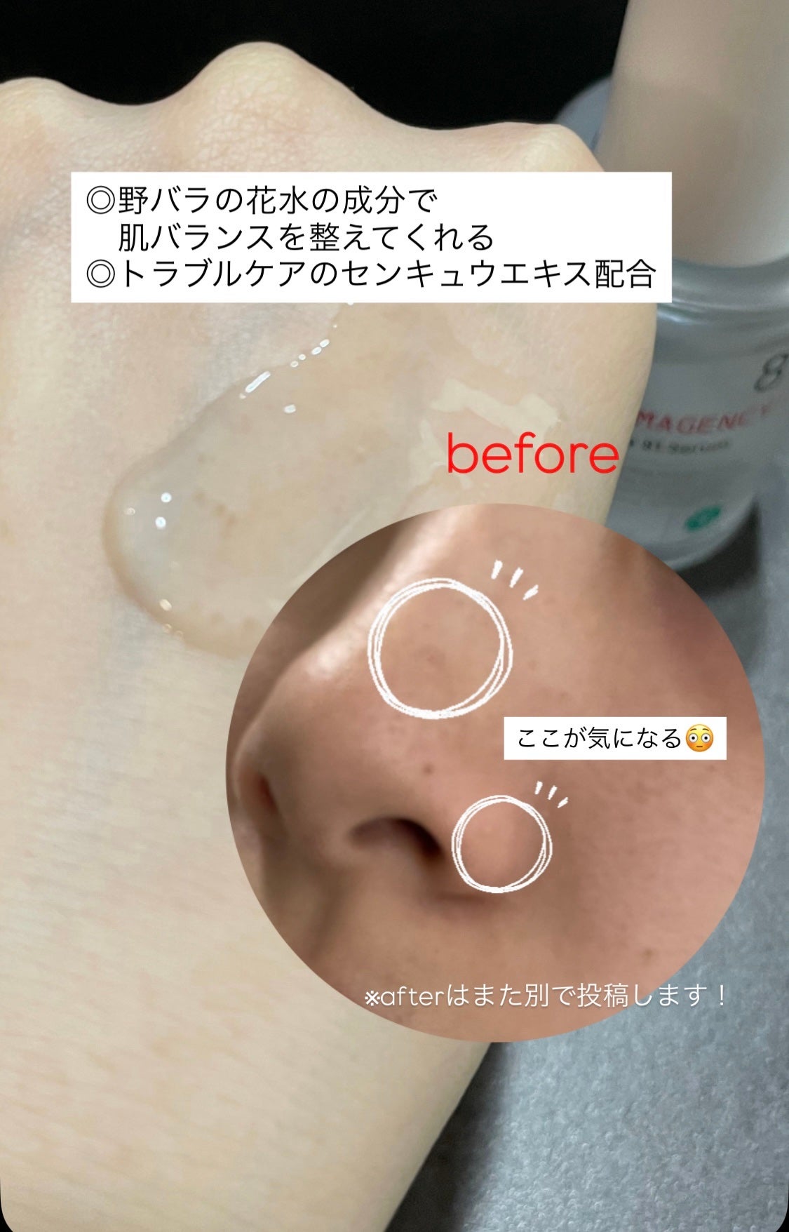 ダーマジェンシー ゼロカ81 セラム/DERMAGENCY/美容液を使ったクチコミ(2枚目)