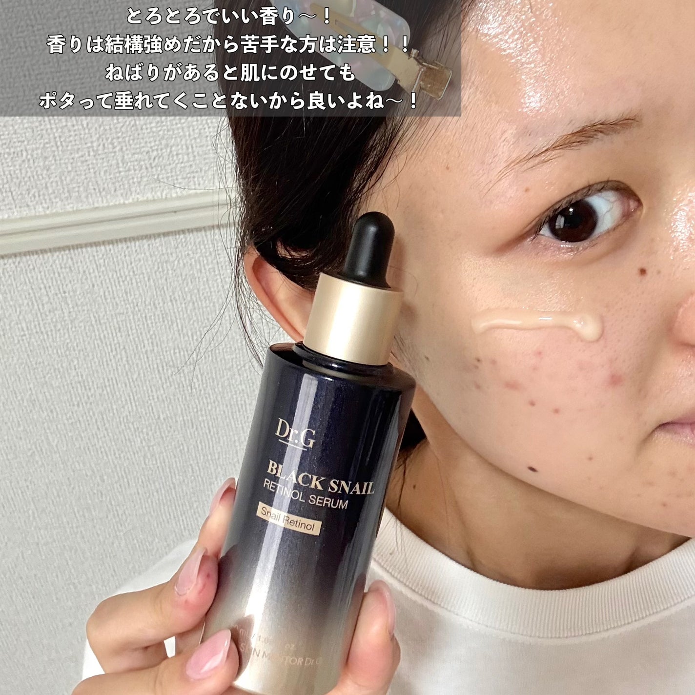 ブラックスネイル クリーム/Dr.G/フェイスクリームを使ったクチコミ(5枚目)