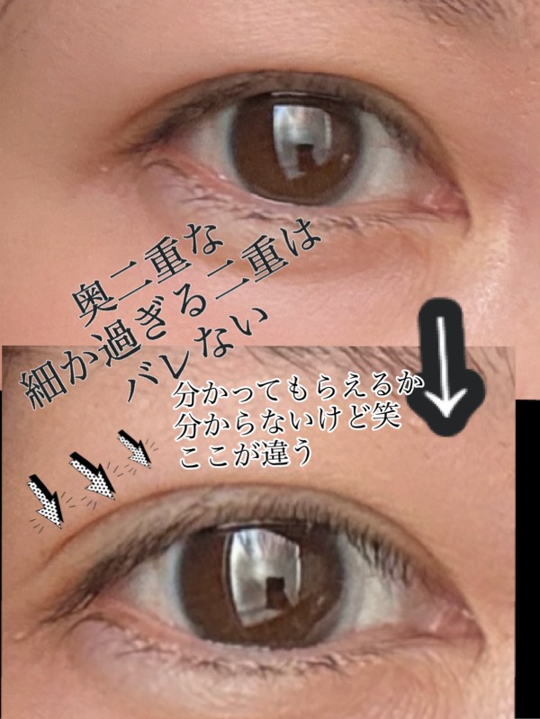 ダブリー/ルドゥーブル/二重まぶた用アイテムを使ったクチコミ（2枚目）