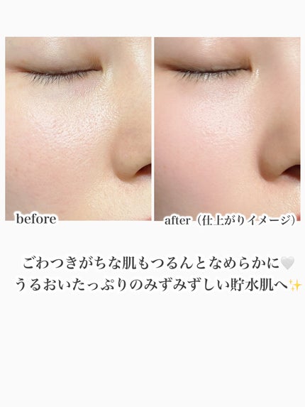 ミノン アミノモイスト モイストチャージ ミルク/ミノン/乳液を使ったクチコミ(5枚目)