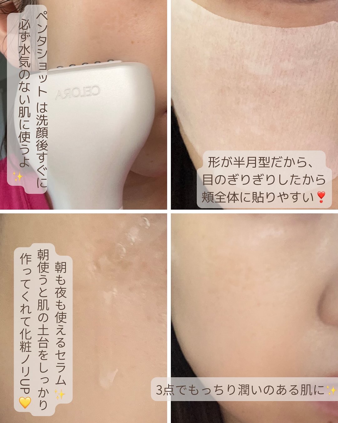 ペンタショット/CELORABY/美顔器・マッサージを使ったクチコミ（2枚目）