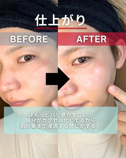 PDRNヒアルロン酸カプセル100セラム/Anua/美容液を使ったクチコミ(4枚目)