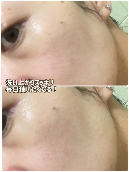 フィトリリーフシカジェルクレンザー/THANK YOU FARMER/その他洗顔料を使ったクチコミ(4枚目)