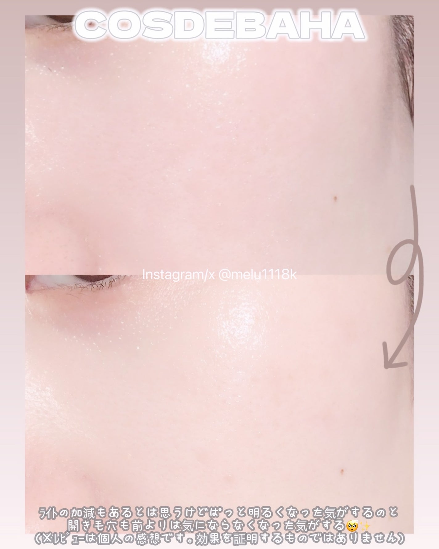 Tranexamic Acid Niacinamide/コスデバハ/美容液を使ったクチコミ(5枚目)