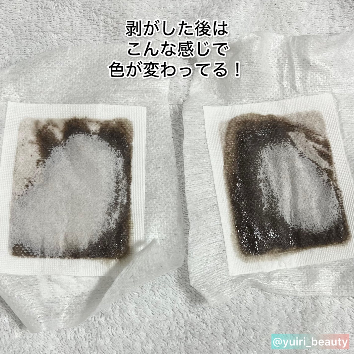 あしやすめ 足裏樹液シート/鎌倉ライフ/レッグ・フットケアを使ったクチコミ(4枚目)