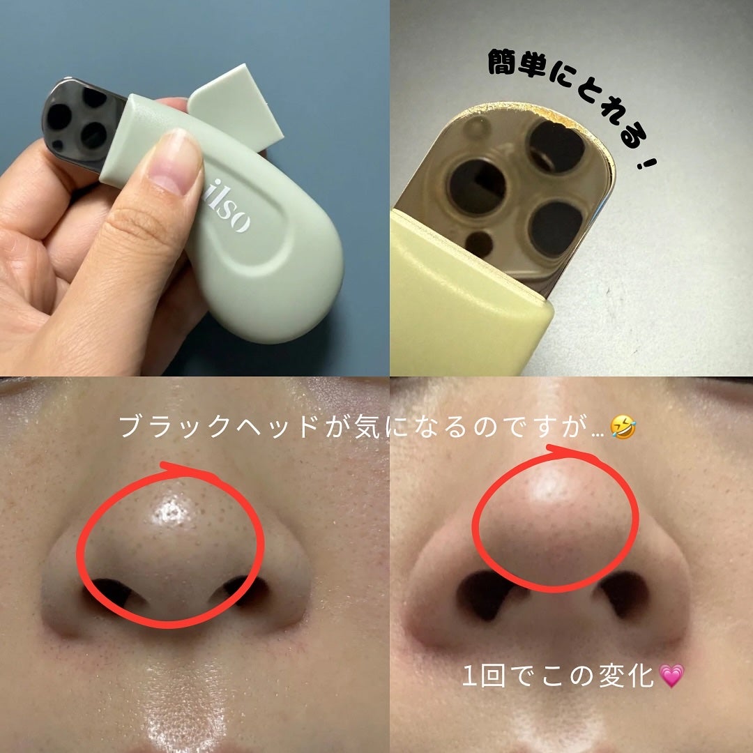 ディープクリーンマスター/ilso/その他スキンケアグッズを使ったクチコミ(3枚目)