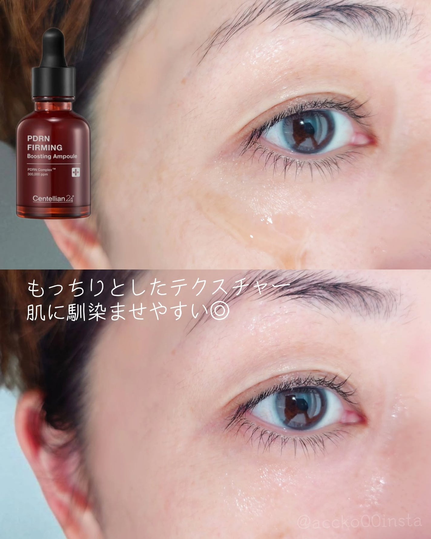 ピーディーアールエヌファーミングブースティングアンプル/センテリアン24/美容液を使ったクチコミ(5枚目)