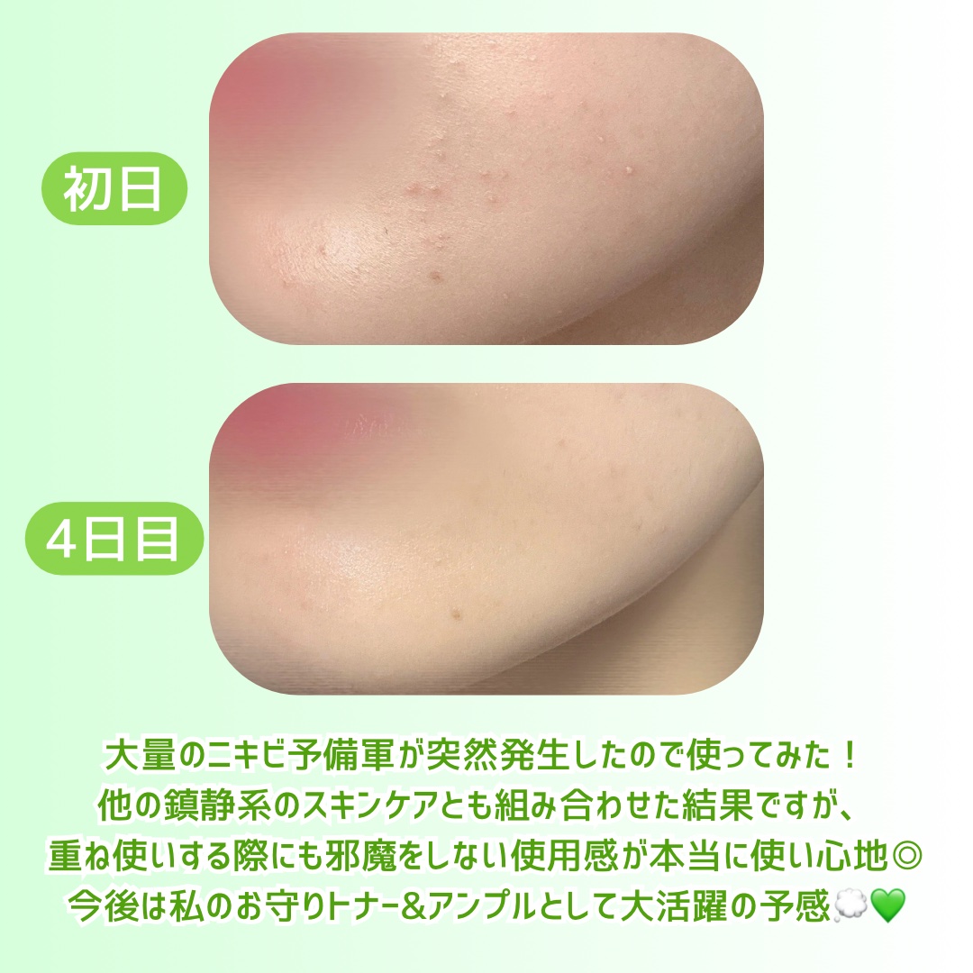 Noni Ampule/celimax/美容液を使ったクチコミ（3枚目）