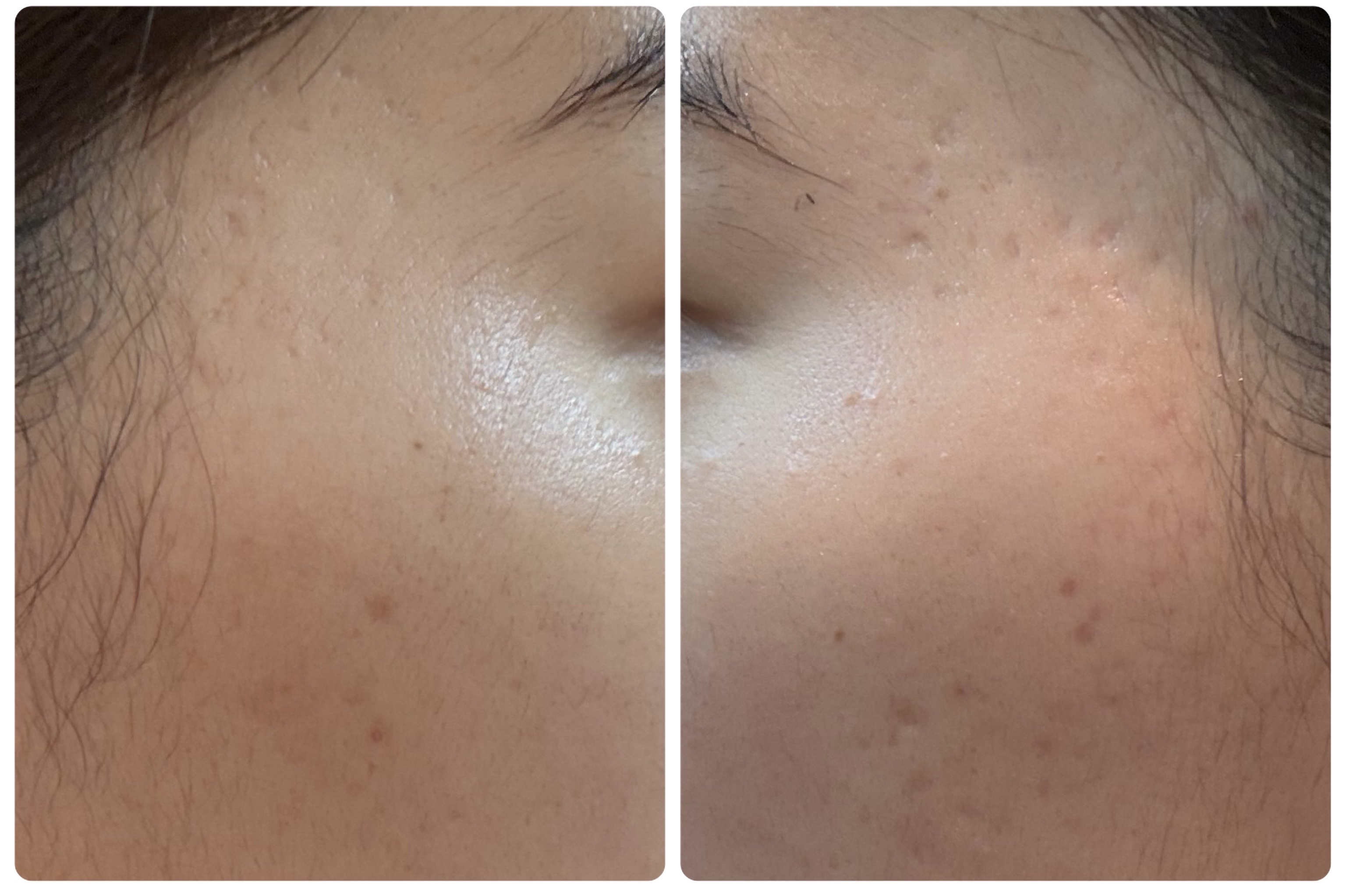 ディープブーストセラム/ブルーミオ/美容液を使ったクチコミ（2枚目）