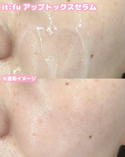 アップトックスアンプル/it:fu/美容液を使ったクチコミ(4枚目)