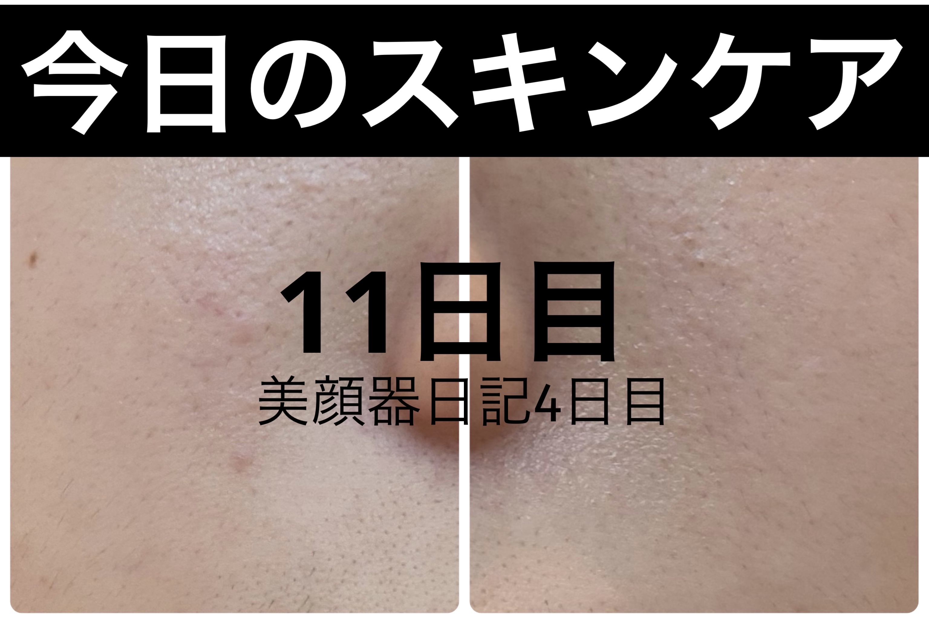 ディープブーストセラム/ブルーミオ/美容液を使ったクチコミ（1枚目）