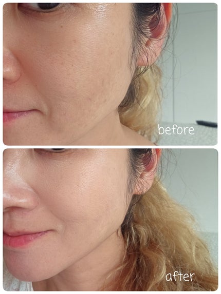 リフレクション スキン グロウ クッション ファンデーション/HERA/クッションファンデーションを使ったクチコミ(4枚目)