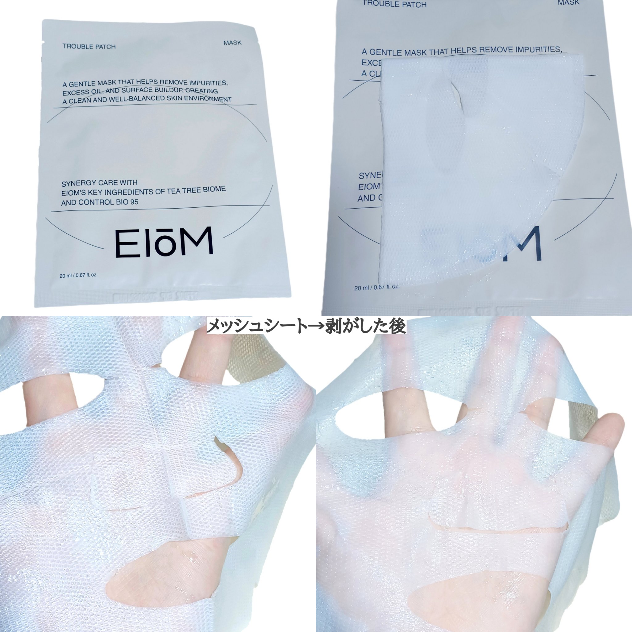 トラブルパッチマスク/EIOM/その他スキンケアを使ったクチコミ（3枚目）