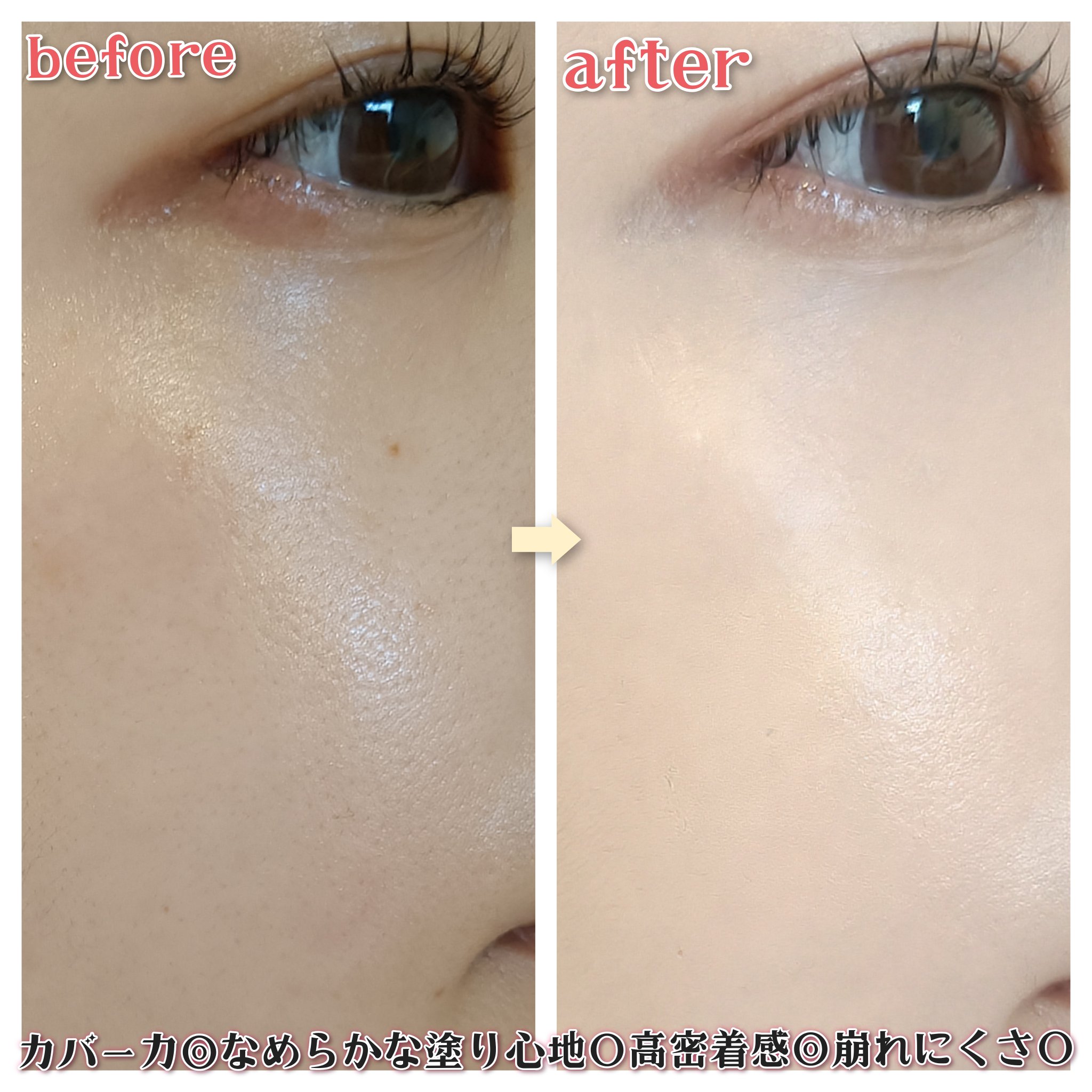 アイシーフィットカバークッションEX/TFIT/クッションファンデーションを使ったクチコミ（3枚目）